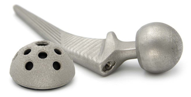 Medical 3D Printing: Custom Implants, Surgical Guides and Training Models